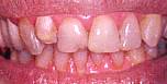 DENTYSTA KIELCE